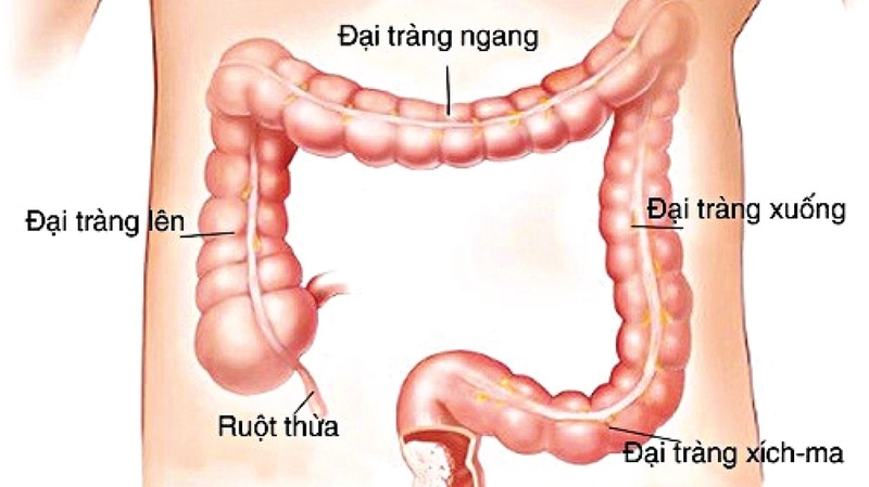 noi-soi-dai-truc-trang-la-phuong-phap-gi-khi-nao-can-thuc-hien-ky-thuat-nay 1