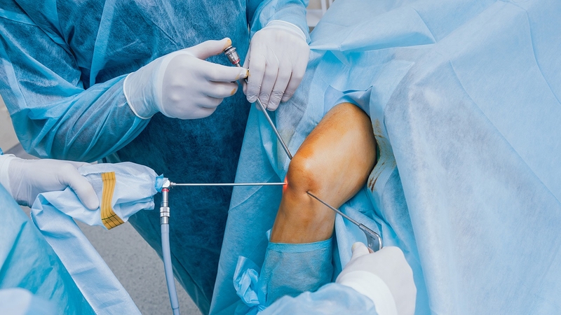 Nội soi khớp gối là gì? Ưu điểm và chỉ định thực hiện 1