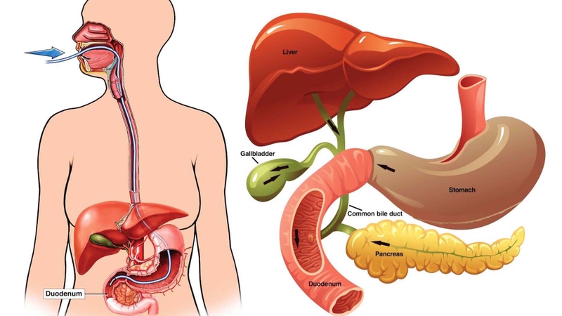 Nội soi mật tụy ngược dòng là gì? Có biến chứng không? 1