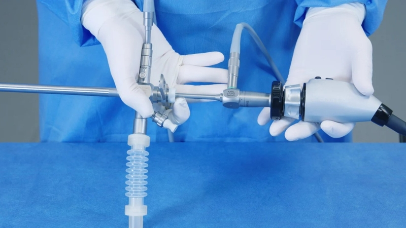 Nội soi phế quản ống cứng: Chỉ định, chống chỉ định, biến chứng 1