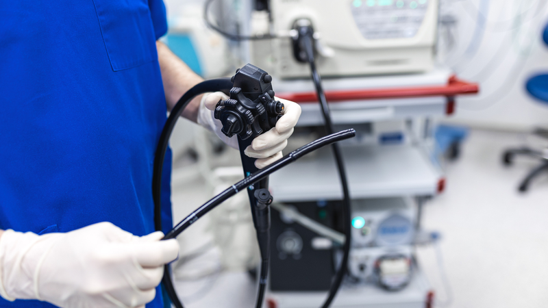 Nội soi tiêu hóa dưới: Phương pháp chẩn đoán hiệu quả các bệnh lý đường ruột 3