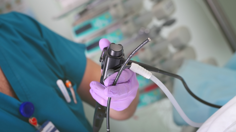 Nội soi tiêu hóa không đau: Giải pháp hiện đại cho sức khỏe tiêu hóa 4