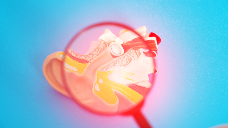 nội soi vá nhĩ 1