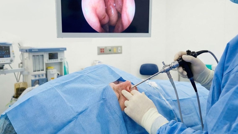 Thủ thuật nội soi được tiến hành nhẹ nhàng, ít ảnh hưởng đến sức khỏe