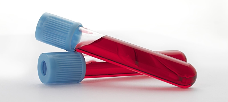 Non HDL cholesterol là gì và tầm quan trọng của nó đối với sức khỏe 2