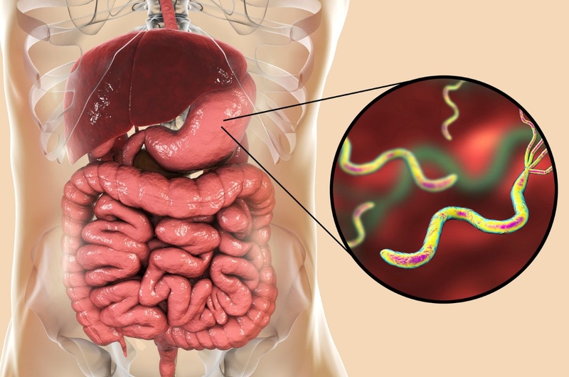 Nóng bụng cảnh báo bệnh gì? Cách điều trị nóng bụng 3