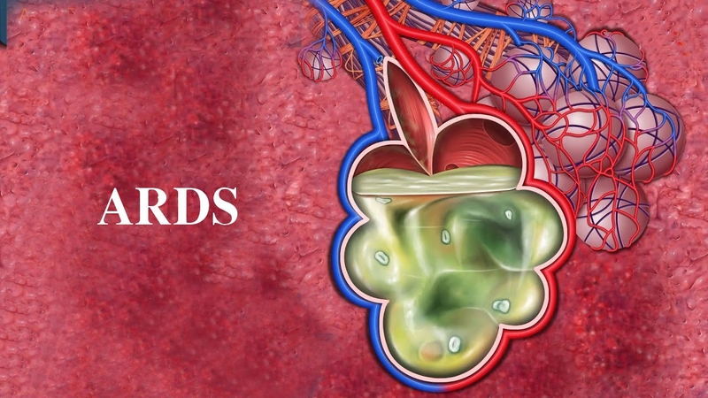 Nồng độ oxy trong máu thấp và bình thường: Những điều cần biết 3