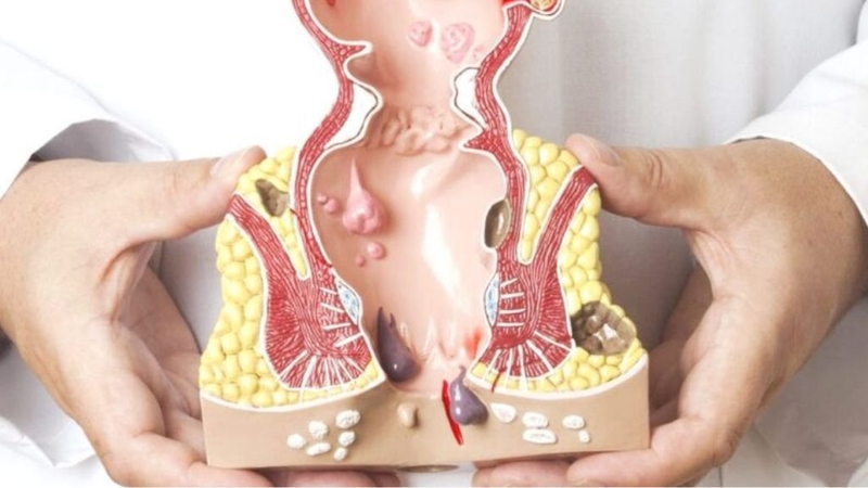 Nong hậu môn cho trẻ sơ sinh và những điều cần biết 1