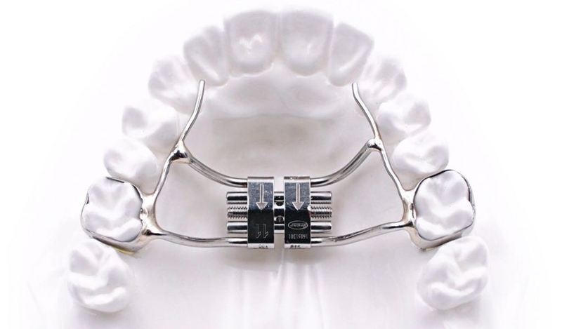 Nong xương là gì? Khi nào cần thực hiện loãng xương? 1