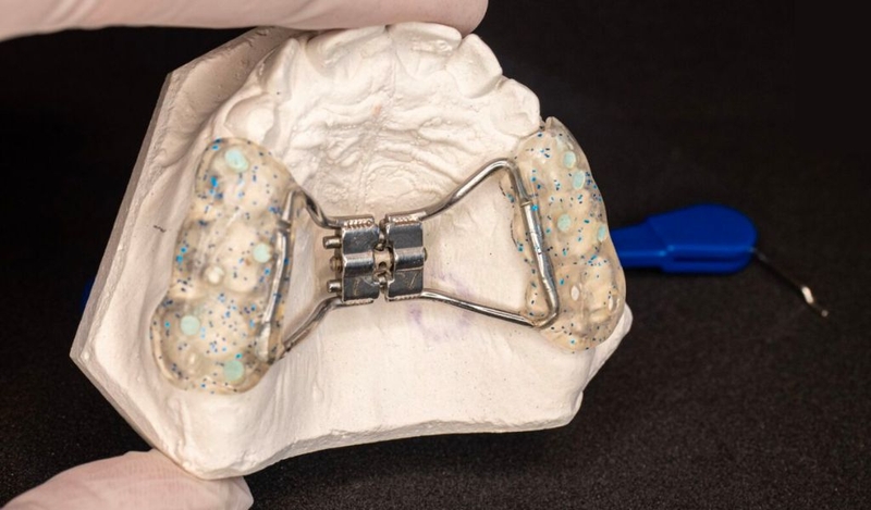 Nong xương là gì? Khi nào cần thực hiện loãng xương? 2