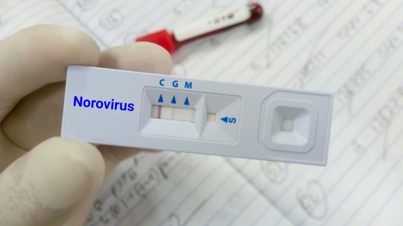 Sau khi phát hiện ca bệnh, hãng tàu tăng cường vệ sinh và phối hợp lấy mẫu xét nghiệm