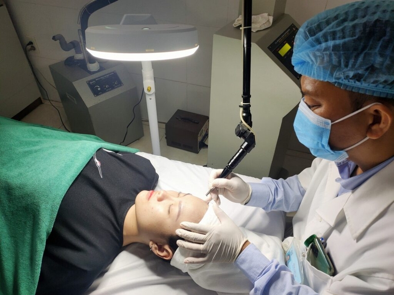 nốt ruồi trên mặt 2