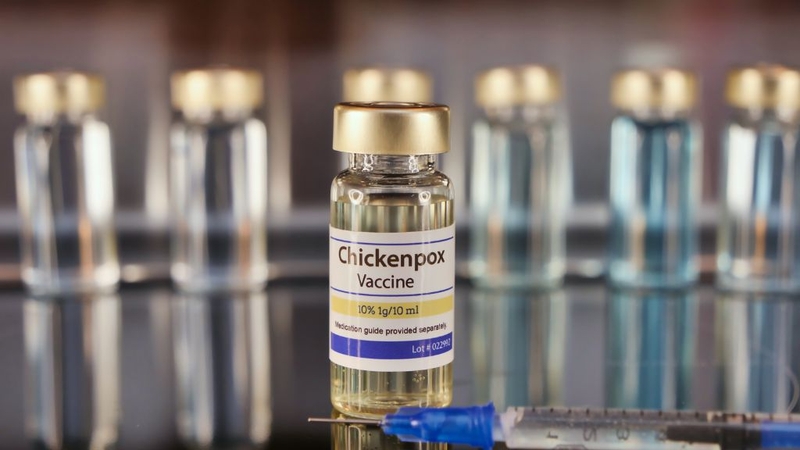 Nốt thủy đậu có mủ phải làm sao? Có nguy hiểm không? 4