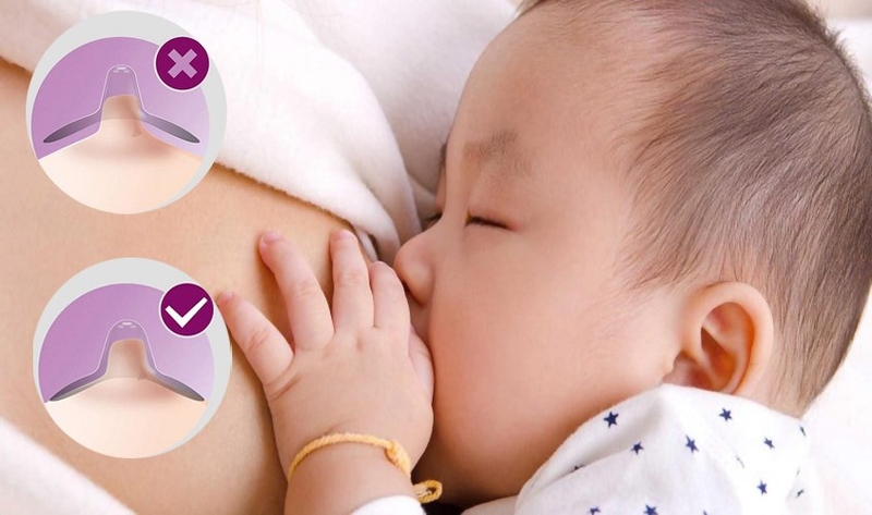 Núm trợ ti là gì? Nên dùng hay không? 2