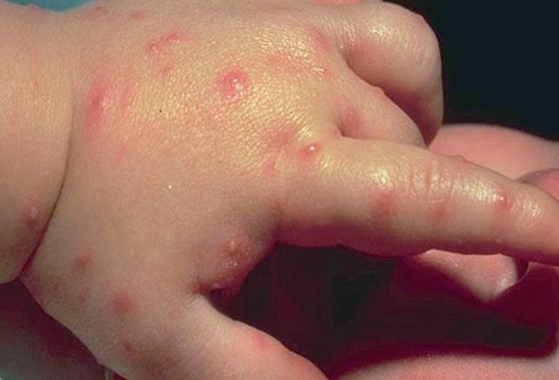 bi-kien-can-noi-mun-nuoc-va-cach-xu-ly-an-toan-1