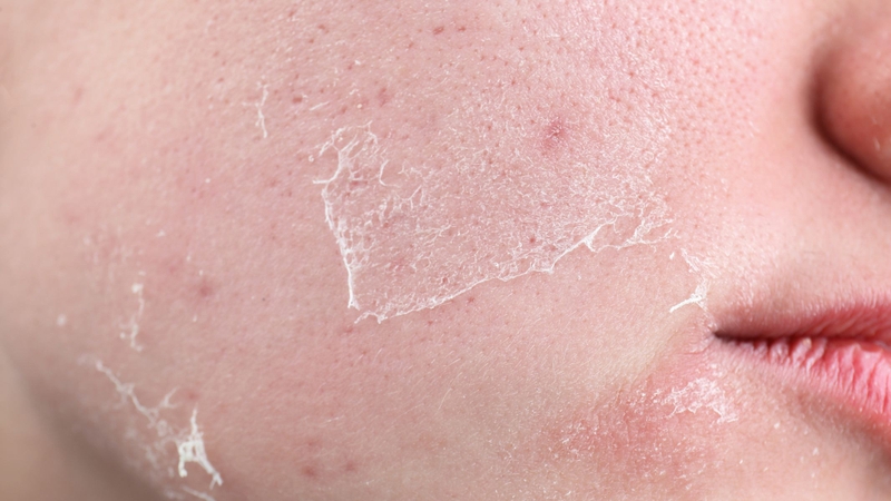 Nước cứng là gì? Tác hại đối với sức khỏe 2