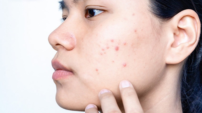 Nước hoa hồng có tẩy trang được không? Hướng dẫn bạn tẩy trang đúng cách cho da sạch đẹp 2