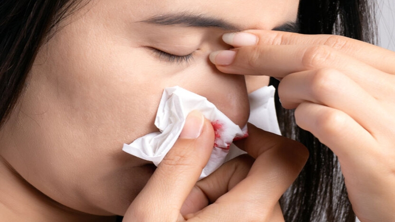 Nước mũi có máu: cảnh báo từ chuyên gia! 2