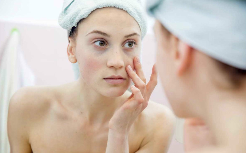 Hình ảnh dị ứng da mặt và những điều cần biết về dị ứng da mặt 4