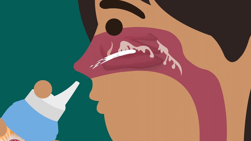 Nước muối ưu trương “giải quyết bài toán” về hô hấp ở trẻ nhỏ 2