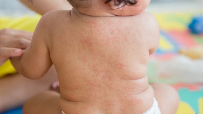 Nước tắm gội thảo dược cho bé Kutieskin CVI: Tác dụng thế nào? 3