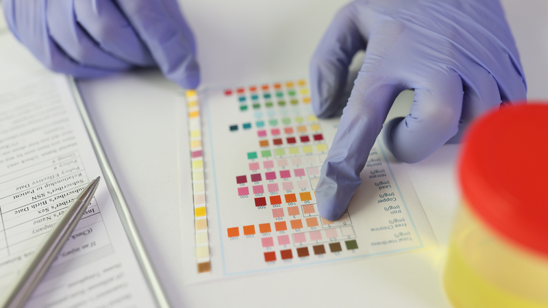 Nước tiểu đổi màu nói lên điều gì?3