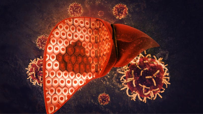 Chức năng gan bị suy giảm cũng có thể làm nước tiểu thay đổi màu sắc