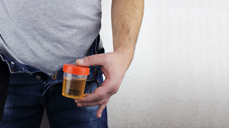 Xét nghiệm nước tiểu là xét nghiệm cơ bản giúp phát hiện sớm bệnh lý