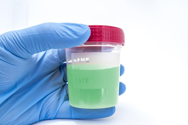 Nước tiểu màu xanh cảnh báo bệnh lý gì? Có gặp nguy hiểm không? 1