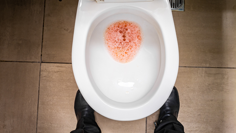 Nước tiểu nổi bọt có thể là dấu hiệu cho thấy thận không giữ được protein