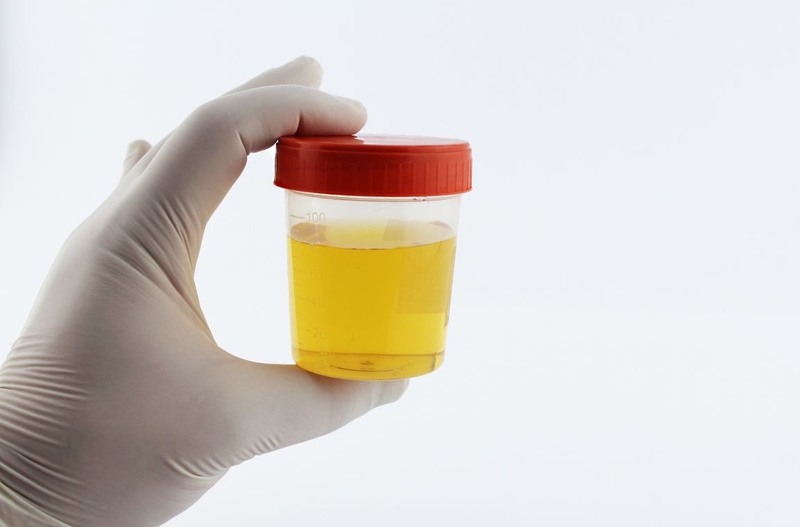 Nước tiểu nóng cảnh báo bệnh gì? Nguyên nhân do đâu 2