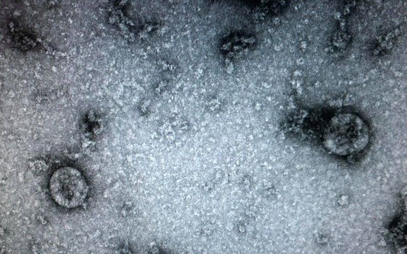 Nuôi cấy và phân lập thành công virus Corona tại Việt Nam