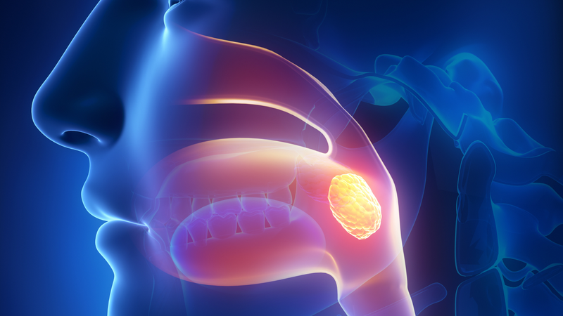 Tìm hiểu về tình trạng nuốt đau: Nguyên nhân và cách giảm đau hiệu quả 1