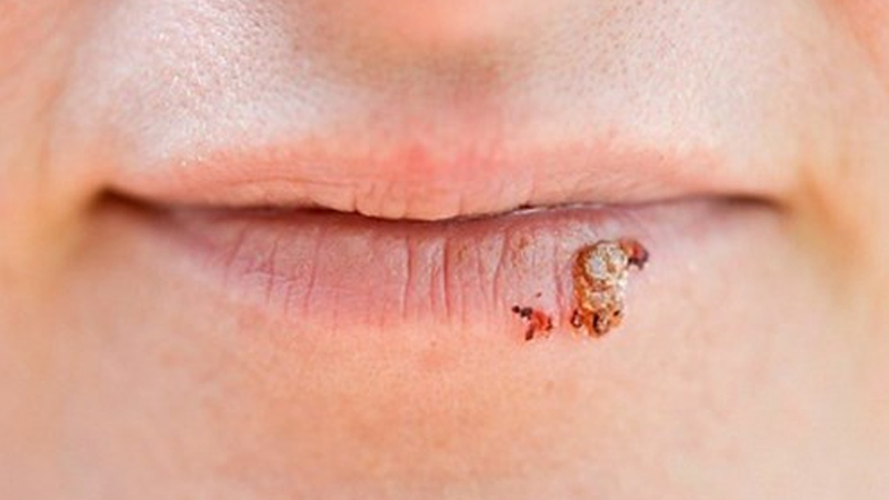 Nuốt tinh trùng có sao không?