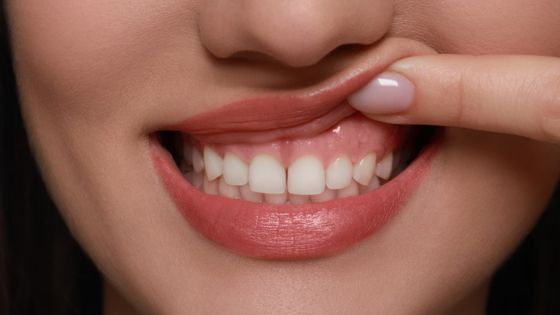 Nướu răng là gì? Cấu tạo, chức năng và các bệnh liên quan 2