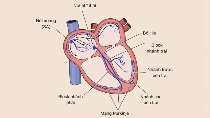 Nút xoang nhĩ là một nhóm tế bào cơ tim chuyên biệt nằm ở thành trên tâm nhĩ phải