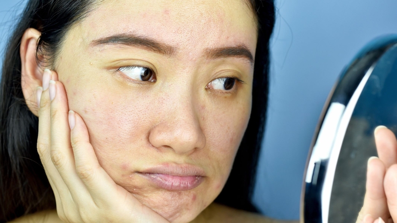 Thức khuya và ngủ không đủ giấc làm gián đoạn quá trình tái tạo tự nhiên của da