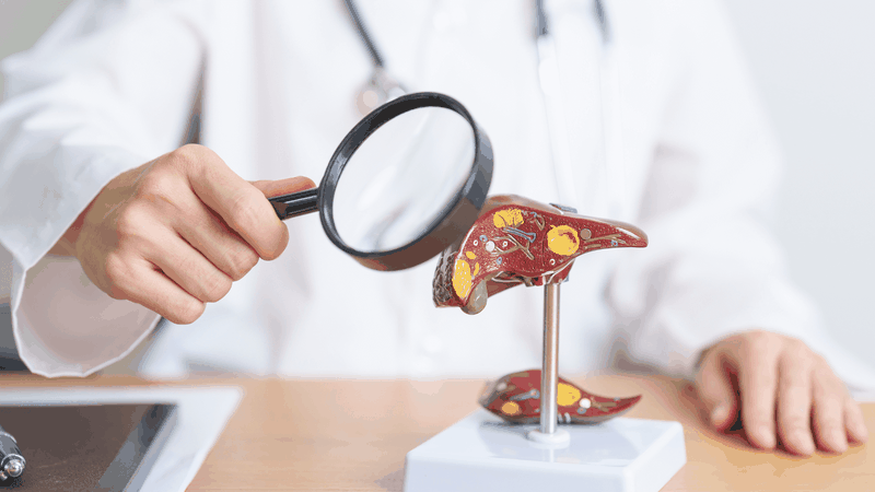 Omega 3 có tốt cho gan không? Sự thật bạn cần biết 1