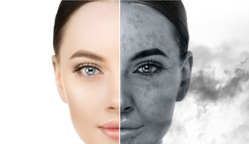 Omega 3 trị mụn nội tiết hiệu quả như thế nào? 2