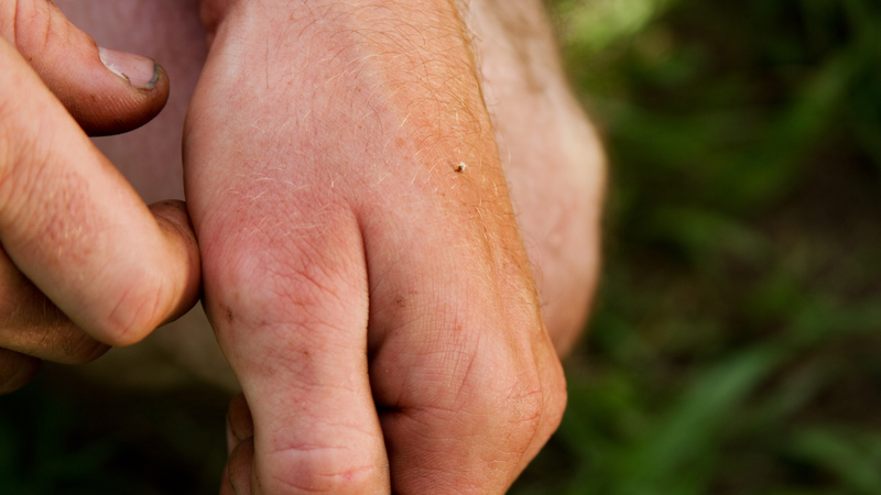 Ong bắp cày đốt gây đau nhức, sưng tấy, kích thích da và phản ứng dị ứng
