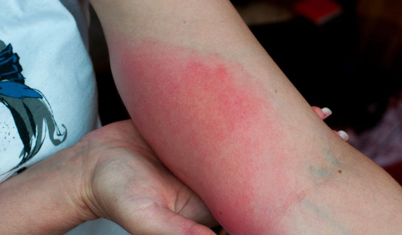 Ong đất có độc không? Cách xử lý và phòng tránh bị ong đốt 2