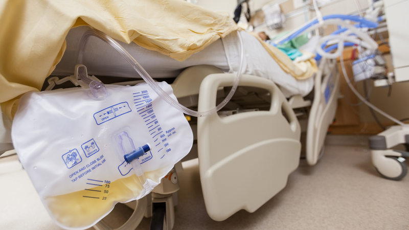 Ống thông tiểu là một dụng cụ dạng ống, được đưa vào bàng quang thông qua niệu đạo