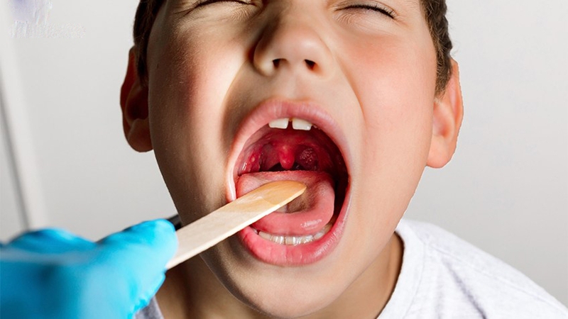 OSA là gì và cách xử lý OSA 6