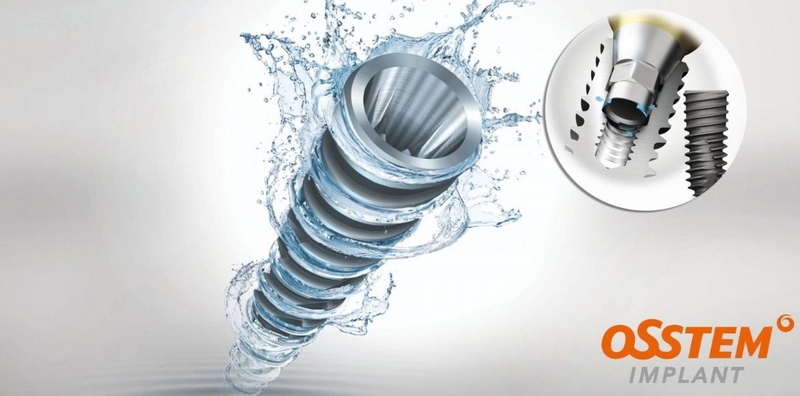 Osstem implant có thật sự hiệu quả ?