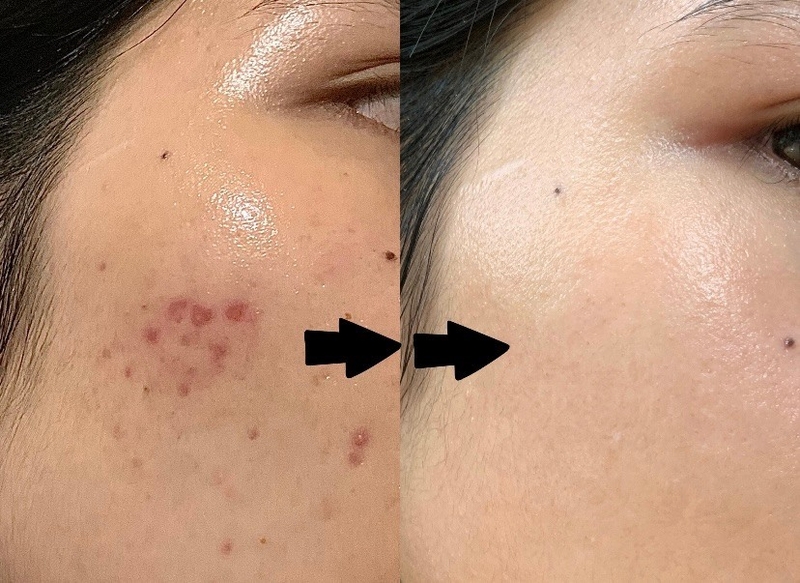 Panthenol là gì? Có tác dụng gì trong chăm sóc da? 3