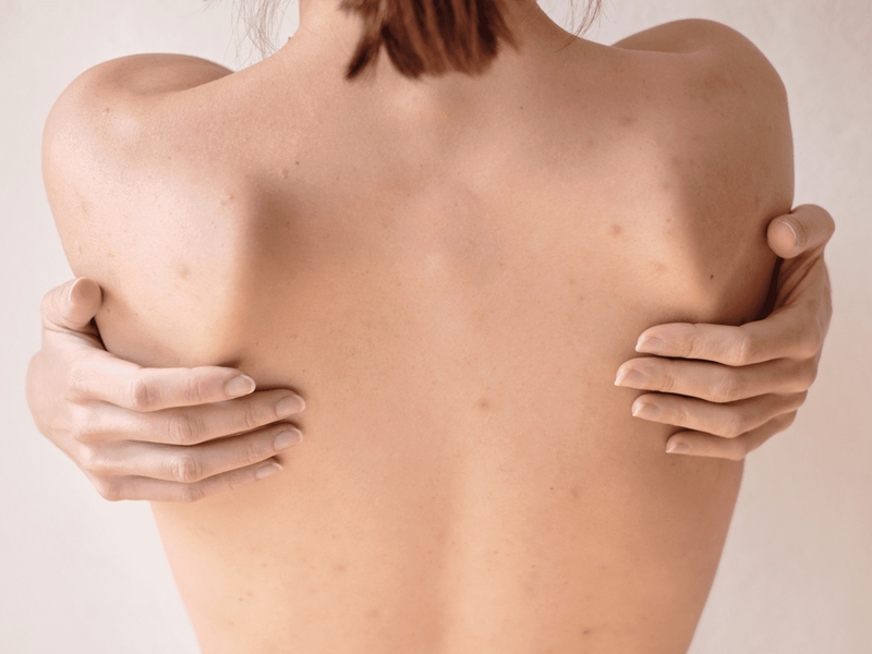 Peel da lưng mang lợi lợi ích như thế nào? 2