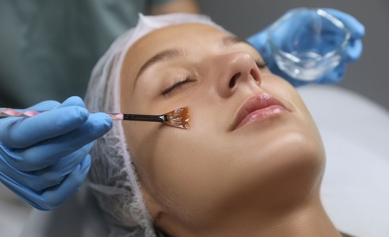 Peel da sau bao lâu thì đẹp? Cách giúp da nhanh tái tạo sau peel 3