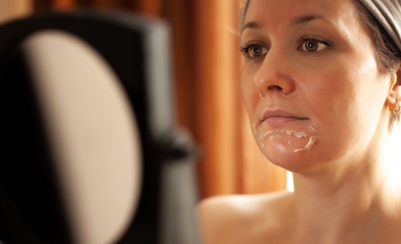 Peel da sau bao lâu thì đẹp? Cách giúp da nhanh tái tạo sau peel 4