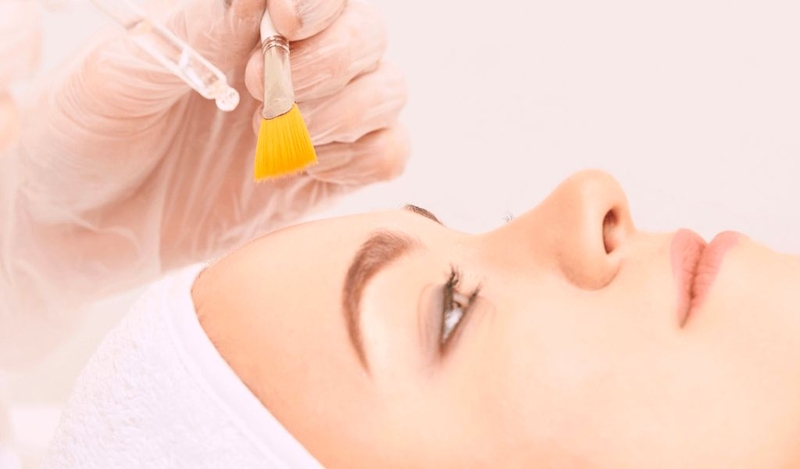 Peel da trị mụn có an toàn không? Có nên thực hiện không? 1