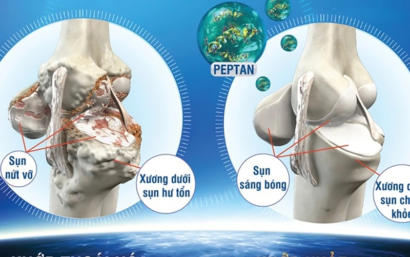 Peptan là gì? Tác dụng của dưỡng chất này đối với xương khớp 1